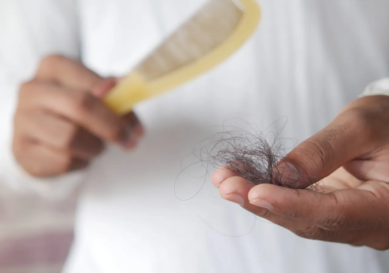 Manchas en la Piel y Caída del Cabello